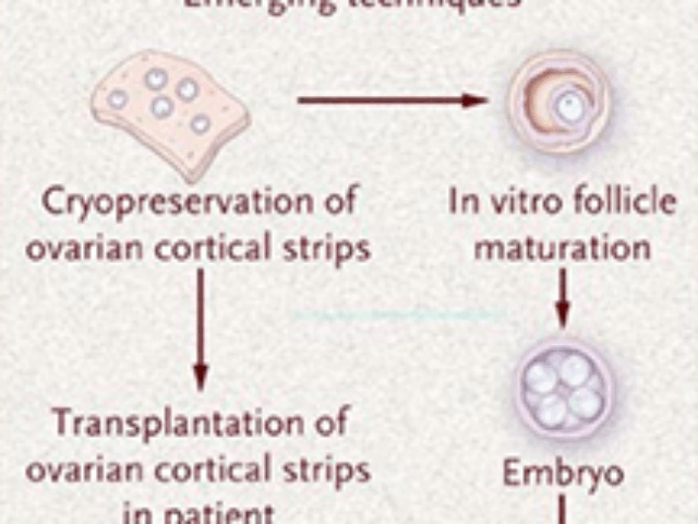 options for the preservation of fertility in patients with cancer