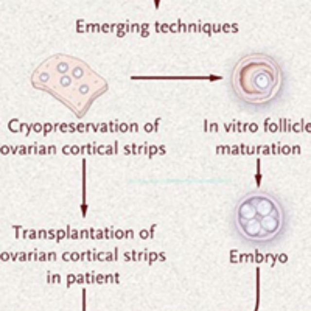 options for the preservation of fertility in patients with cancer
